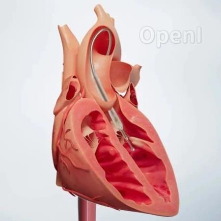 在心脏里“撑起一把伞”,世界最小介入式人工心脏如何诞生?|甲子光年