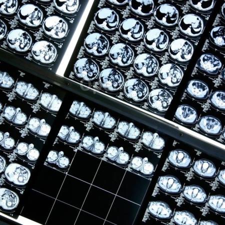 Nature | 一场人工智能革命正在医学领域酝酿,它会是什么样子?