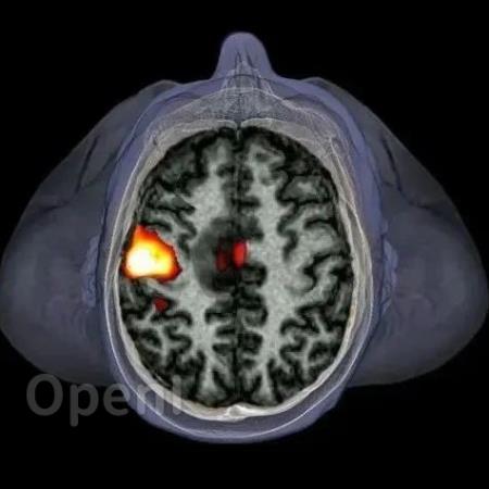 看见神经元活动:fMRI的进步让大脑成像更快更精细 | 《自然》长文