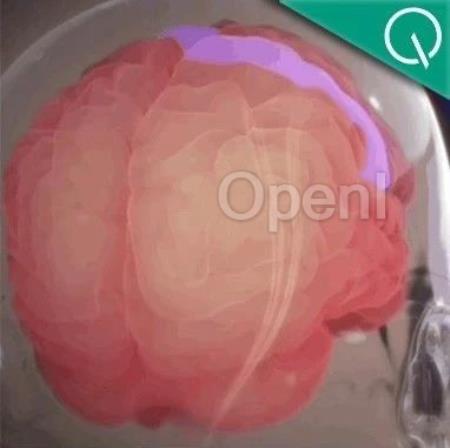 马斯克脑机接口公司再融资4300万美元,临床试验宣传片首次发布,网友:在哪儿付款?