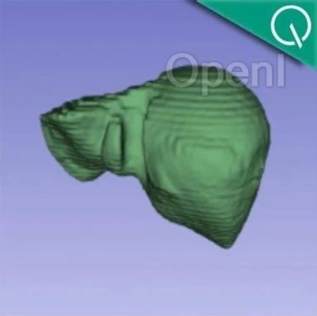 医学通用分割模型来了!一口气分割200多个解剖类别,发布即开源 | 智源出品