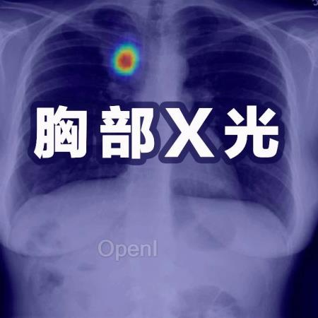 放射科医生再临危机!国外五大机构联合发布「胸部X光」最新基准