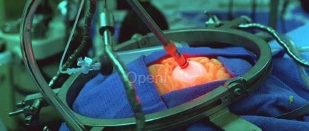 埃隆-马斯克希望将人类与人工智能融合在一起,会有多少大脑会因此受损?