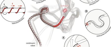 Science Robotics刊发 螺旋磁性机器人可用于疏通血管治疗中风