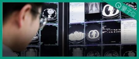 浙江丽水，正在用AI诊癌