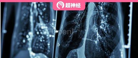 基于美日 627 例患者的临床数据,谷歌证实 AI 辅助肺癌筛查的群体有效性