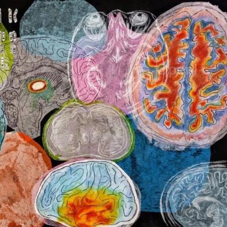 从复杂神经动力学到智能涌现：基于神经复杂性的类脑人工智能