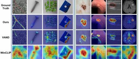 ICLR 2024 | 跨领域准确进行零样本异常检测,浙大等提出AnomalyCLIP