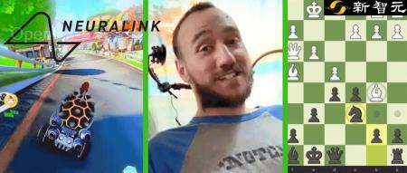 开脑100天，马斯克首位脑机接口患者出故障？瘫痪8年小哥术后并发症惹质疑