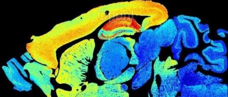 Nature | 从波动到稳定：小鼠研究揭示工作记忆稳定化的神经机制