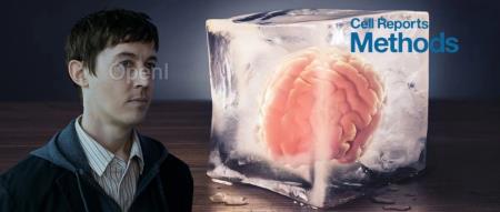 复旦团队重大突破登Cell，破纪录复活「冰封」18个月人脑！三体云天明计划成真？