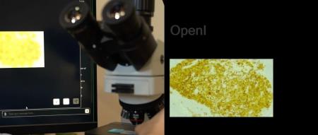 超过 GPT-4V!哈佛医学院 AI 聊天机器人登上 Nature,肿瘤识别率接近 90%