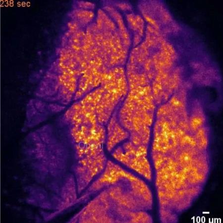 难怪久坐容易痴呆！Science首次发现，大脑里有大量缺氧区，但可大幅缓解