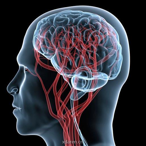 脑血管病预防与治疗