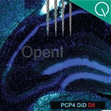 Science正刊:大脑也能重启,睡觉就能增强记忆力