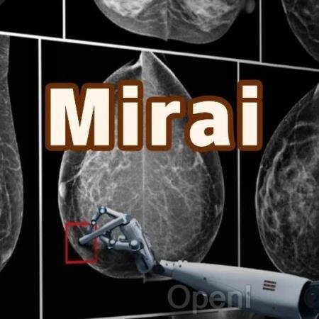 AI模型提早5年预警乳腺癌,MIT研究登Science获LeCun转发