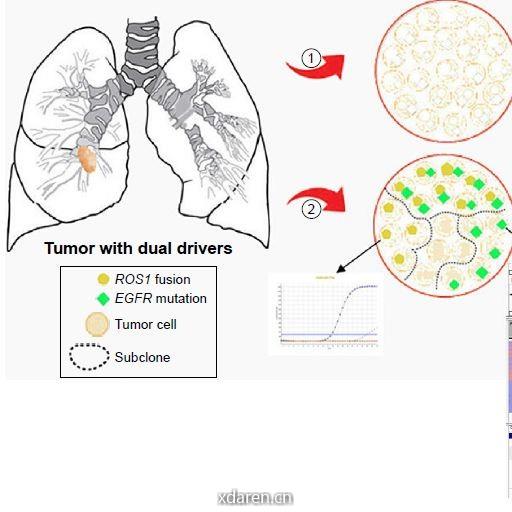 分子检测与治疗前沿