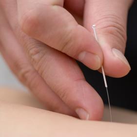 针灸探秘