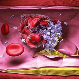 血栓与止血实验室检查