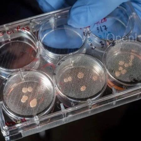 科学家培育出“迷你大脑”，最终会产生意识吗？