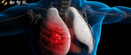 3类严重程度,6级不确定性!德州大学等首创全新胸部X光数据集,登IEEE TMI