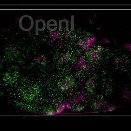 重磅丨十年磨一剑!CAAI 理事长、清华大学戴琼海院士领衔,新一代“超级显微镜”问世