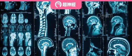 入选ECCV 2024！浙江大合微软亚洲研究院提出统一医学图像预训练框架UniMedI，打破医学数据异构化藩篱