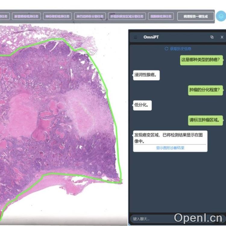AI病理助手来了！浙大OmniPT上岗，3秒锁定癌症病灶，准确率超95%