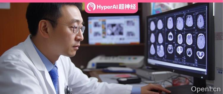 入选AAAI 2025!可实现多模态医学图像对齐与融合,国内两大高校联合提出BSAFusion