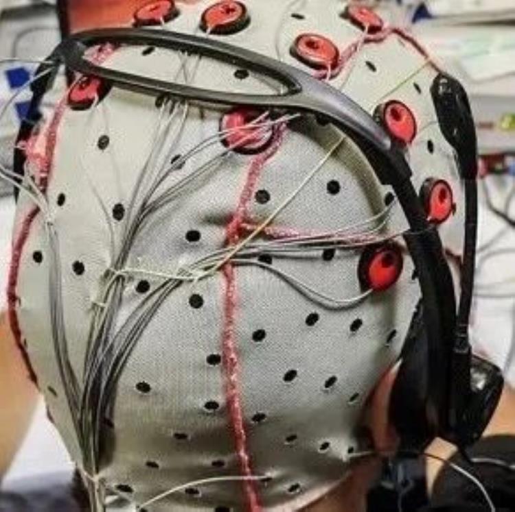 脑机接口预示着未来生活质量的提高