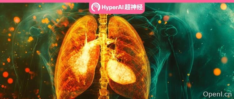 入选AAAI 2025！解决医学图像分割软边界与共现难题，中国地质大学等提出图像分割模型ConDSeg