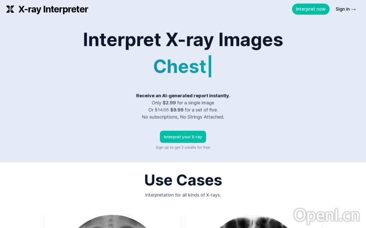 X-ray Interpret